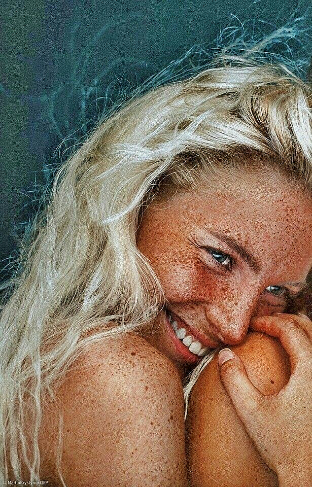 white girl freckles